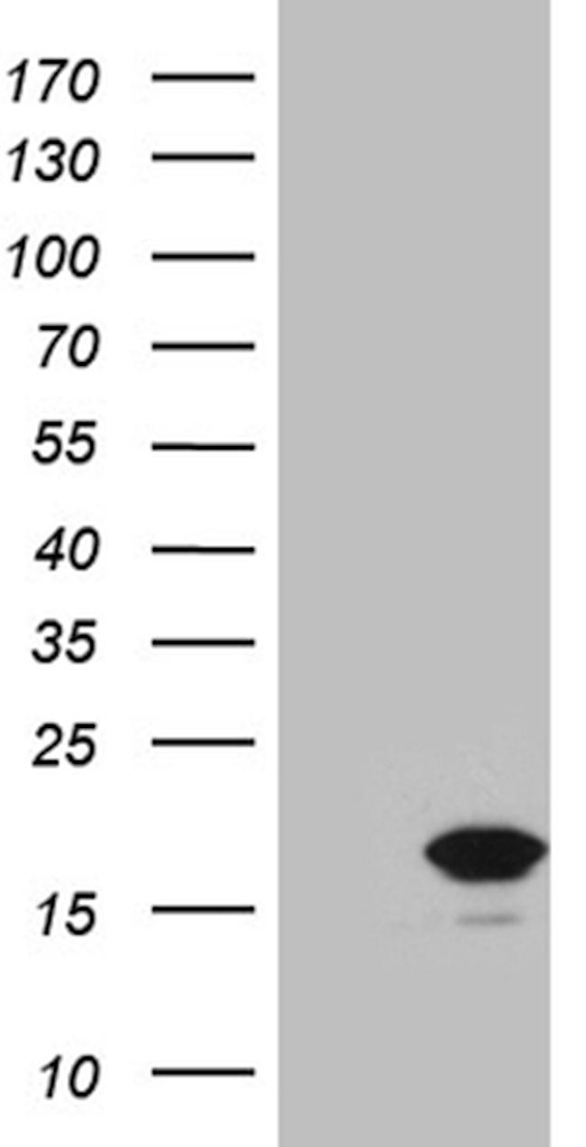 CDKN2A Antibody in Western Blot (WB)