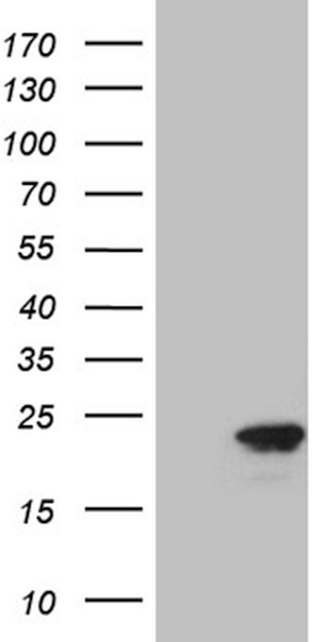 CDKN2A Antibody in Western Blot (WB)