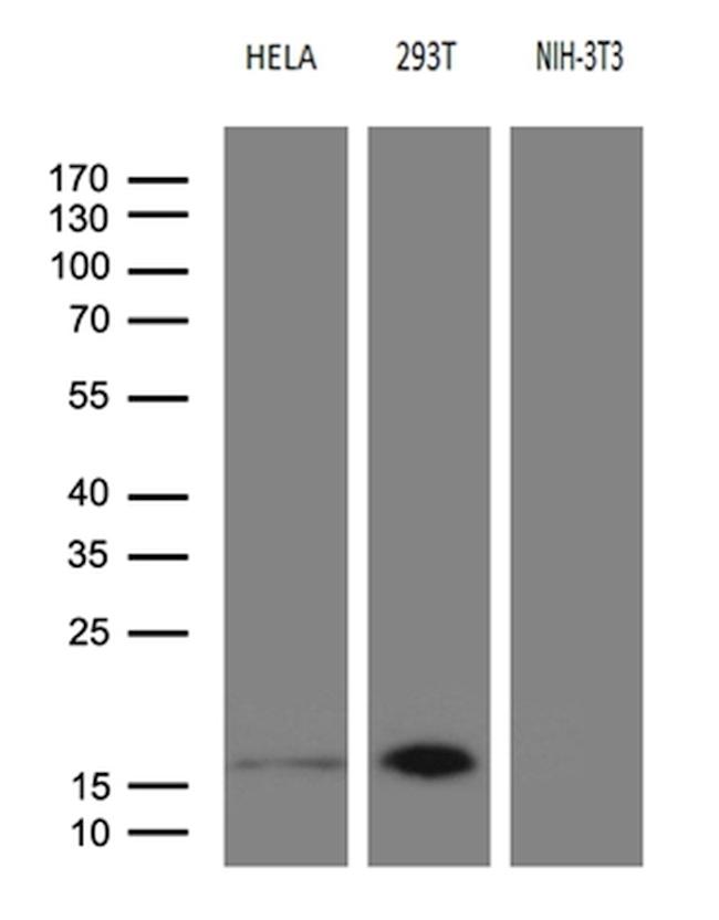 CDKN2A Antibody in Western Blot (WB)