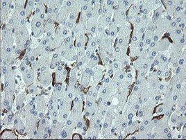 CDKN2B Antibody in Immunohistochemistry (Paraffin) (IHC (P))