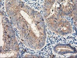 CDKN3 Antibody in Immunohistochemistry (Paraffin) (IHC (P))