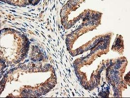 CDKN3 Antibody in Immunohistochemistry (Paraffin) (IHC (P))