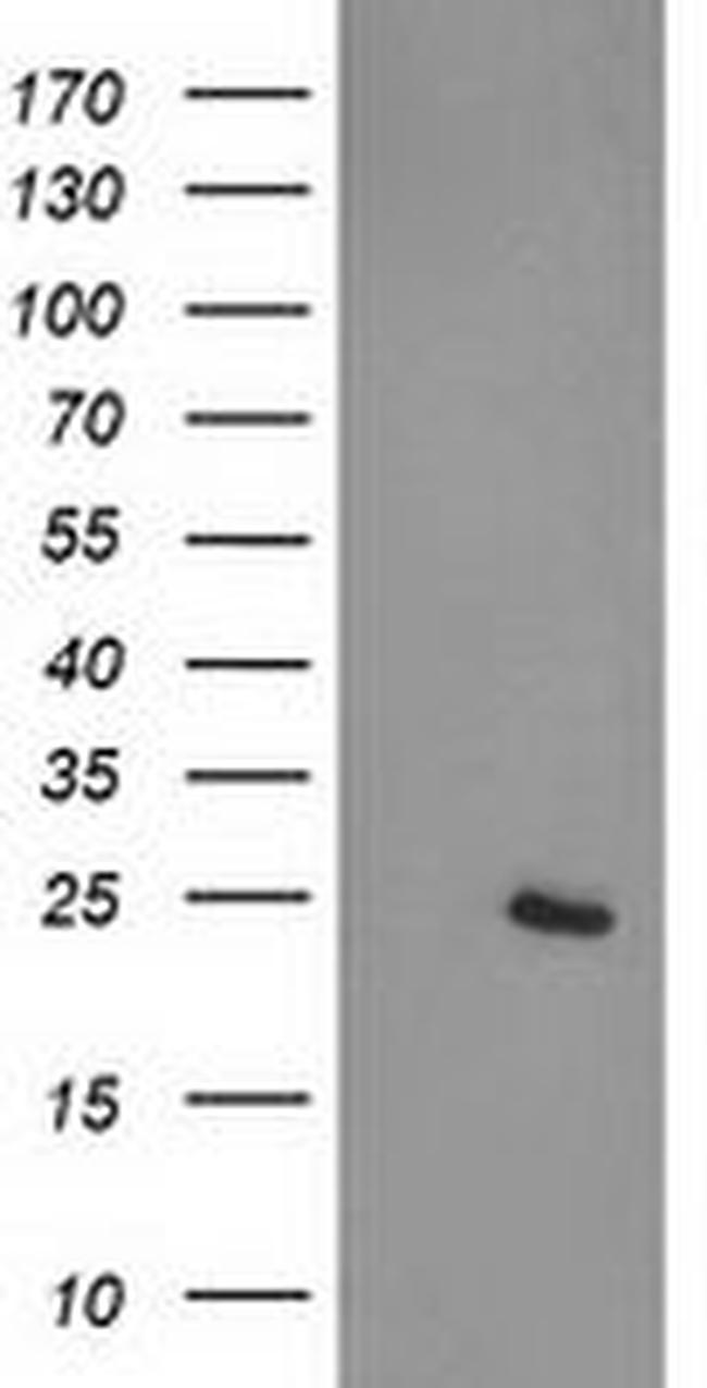 CDKN3 Antibody in Western Blot (WB)