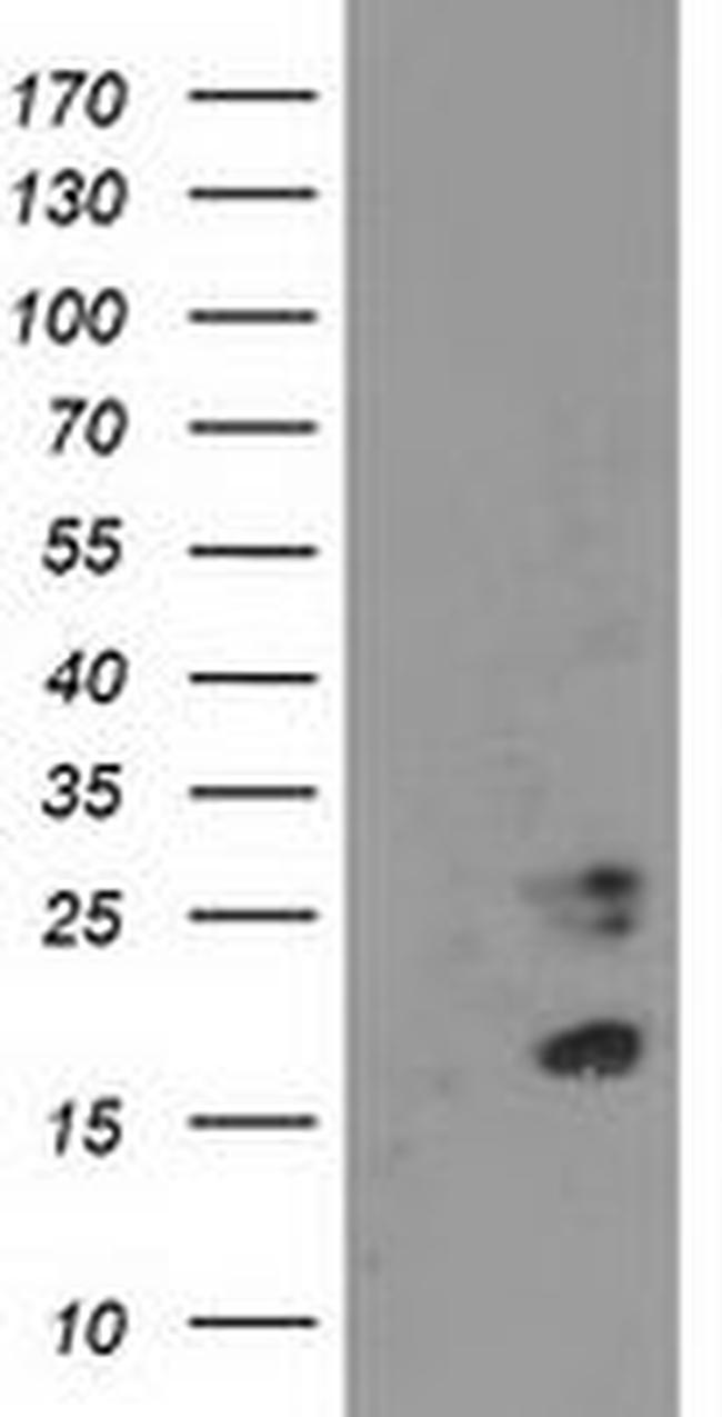 CDKN3 Antibody in Western Blot (WB)