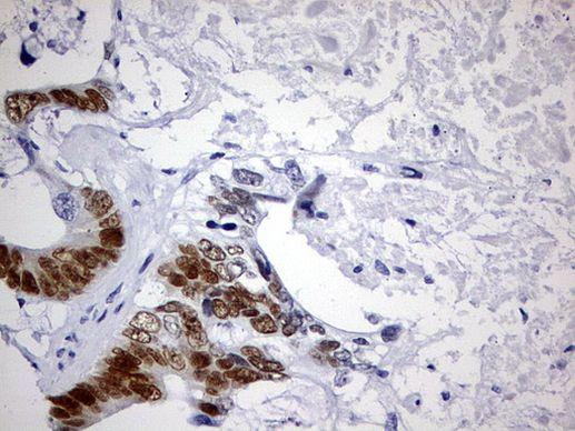 CDX2 Antibody in Immunohistochemistry (Paraffin) (IHC (P))