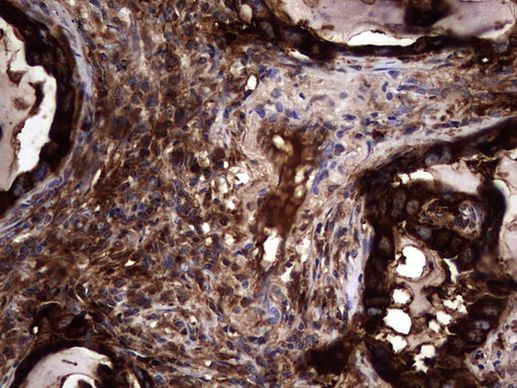 CEA (CEACAM5) Antibody in Immunohistochemistry (Paraffin) (IHC (P))