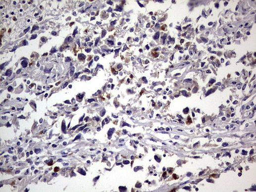 CEA (CEACAM5) Antibody in Immunohistochemistry (Paraffin) (IHC (P))