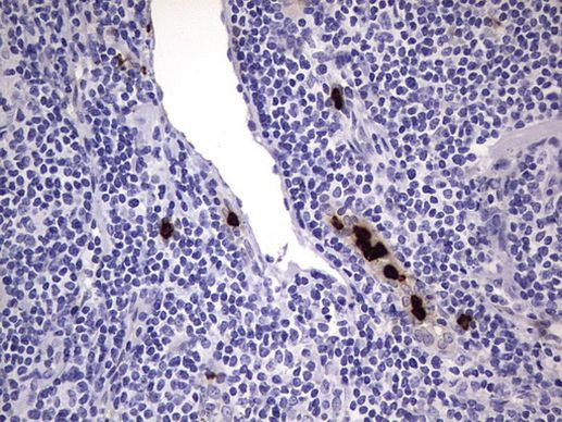 CEA (CEACAM5) Antibody in Immunohistochemistry (Paraffin) (IHC (P))