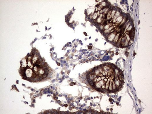 CEA (CEACAM5) Antibody in Immunohistochemistry (Paraffin) (IHC (P))