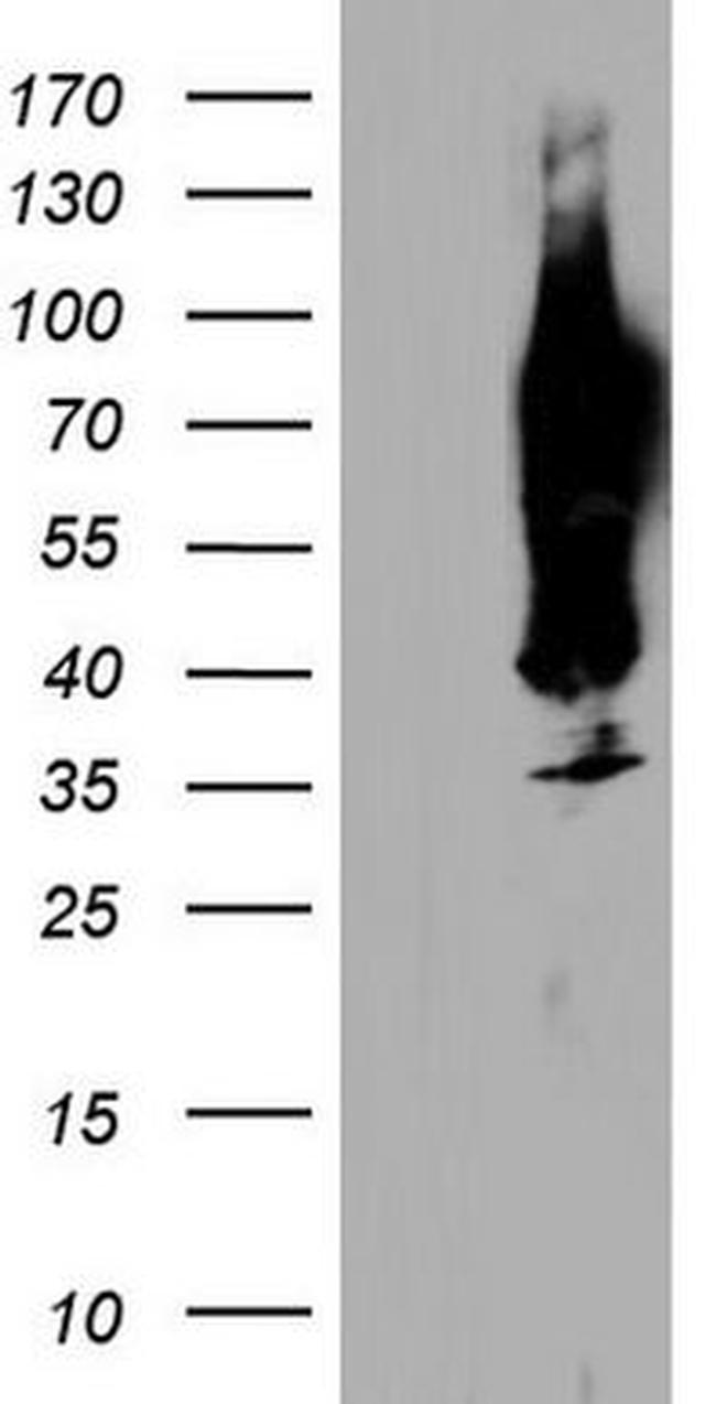 CEA (CEACAM5) Antibody in Western Blot (WB)