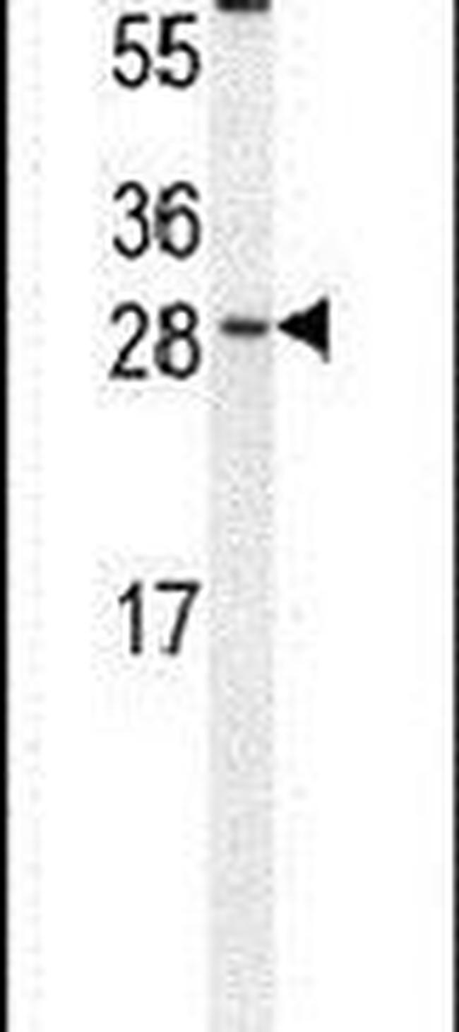 C/EBP gamma Antibody in Western Blot (WB)