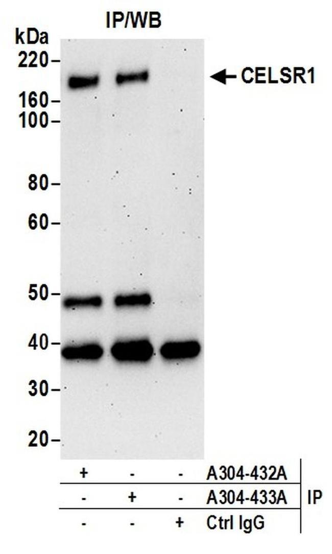 CELSR1 Antibody in Western Blot (WB)