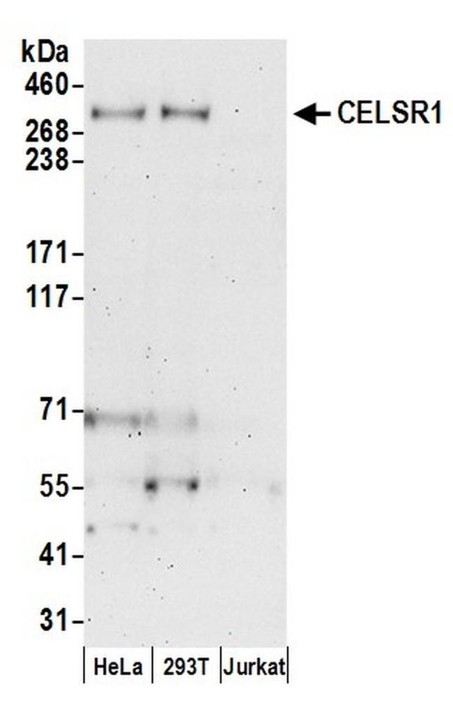 CELSR1 Antibody in Western Blot (WB)