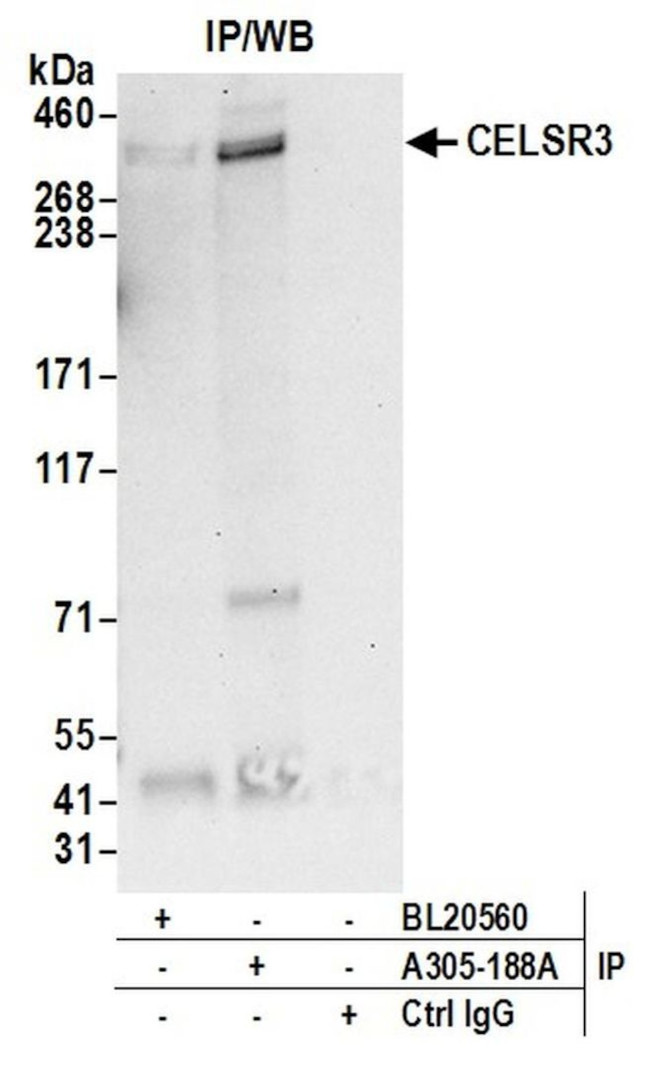 CELSR3/Flamingo Homolog 1 Antibody in Immunoprecipitation (IP)