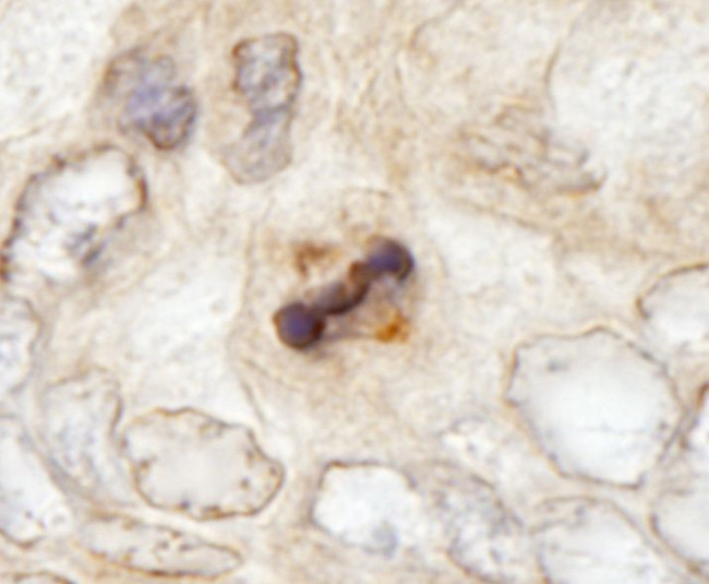 CENP-F/Mitosin Antibody in Immunohistochemistry (IHC)