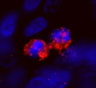 CENP-F/Mitosin Antibody in Immunohistochemistry (IHC)