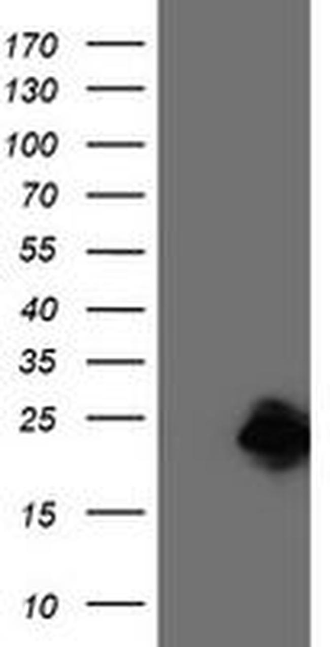 CENPH Antibody in Western Blot (WB)