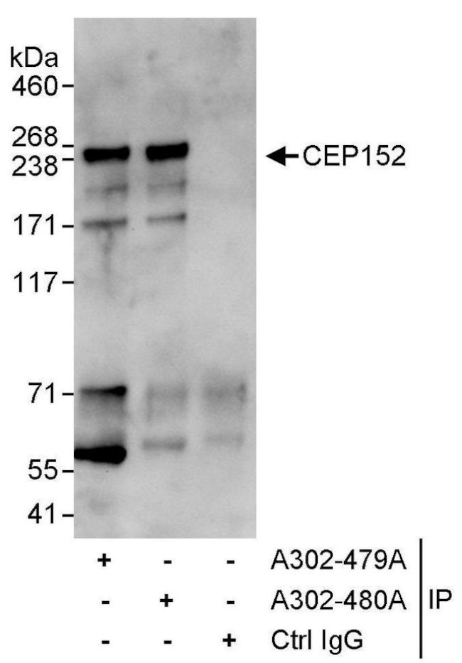 CEP152 Antibody in Immunoprecipitation (IP)