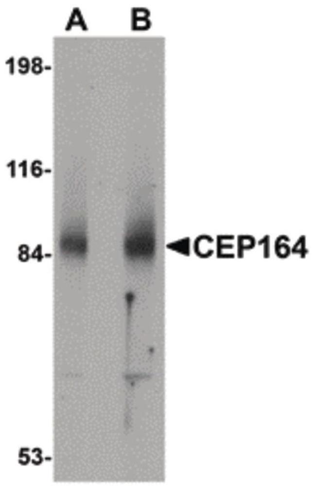 CEP164 Antibody in Western Blot (WB)