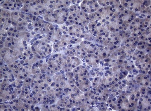 CEP55 Antibody in Immunohistochemistry (Paraffin) (IHC (P))