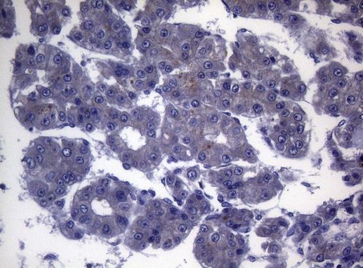 CEP55 Antibody in Immunohistochemistry (Paraffin) (IHC (P))