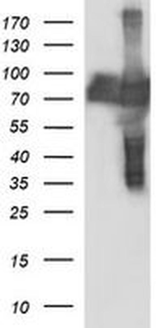 CEP68 Antibody in Western Blot (WB)