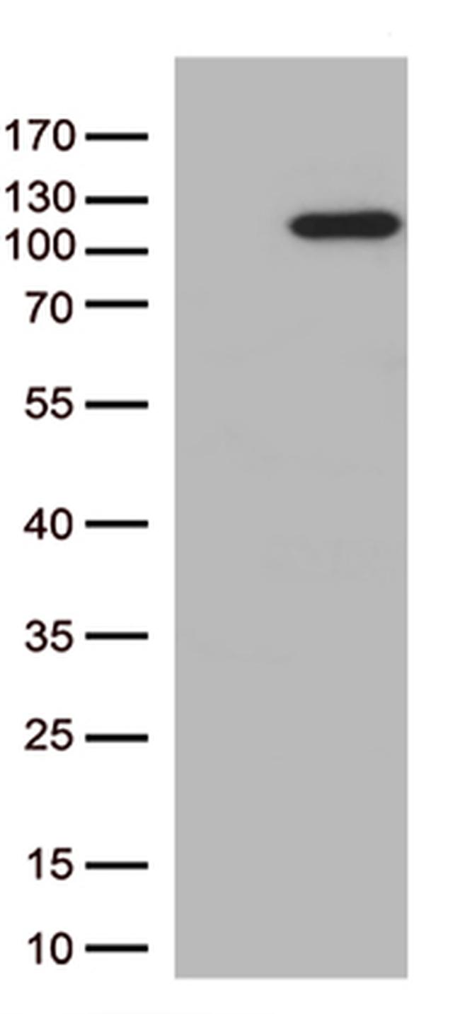 ARTS1 (ERAP1) Antibody in Western Blot (WB)