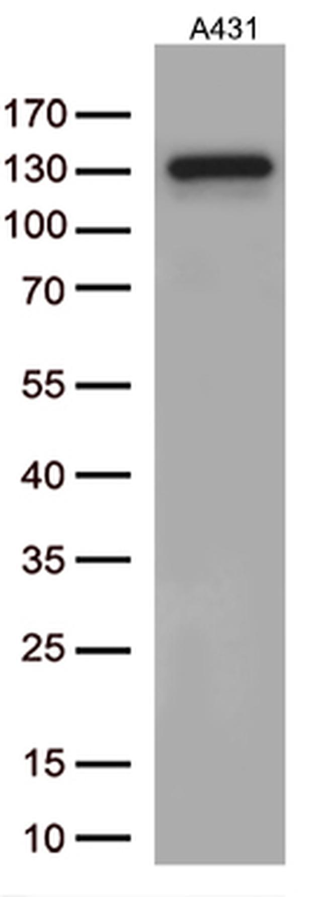 ARTS1 (ERAP1) Antibody in Western Blot (WB)