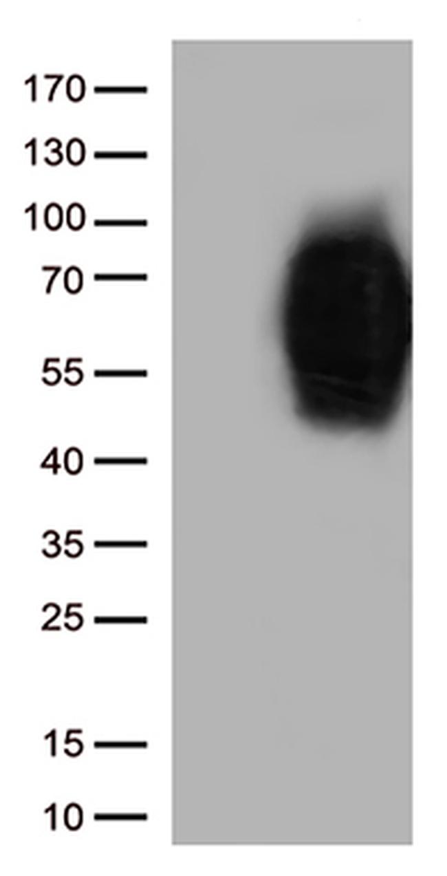 B7-2 (CD86) Antibody in Western Blot (WB)