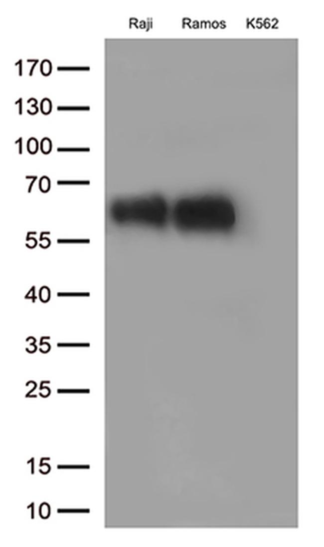 B7-2 (CD86) Antibody in Western Blot (WB)