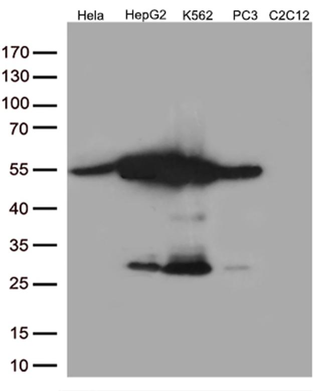 Calreticulin (CALR) Antibody in Western Blot (WB)