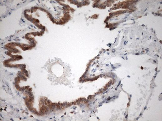 Caspase 3 (CASP3) Antibody in Immunohistochemistry (Paraffin) (IHC (P))