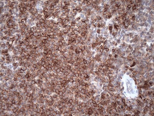 Caspase 3 (CASP3) Antibody in Immunohistochemistry (Paraffin) (IHC (P))