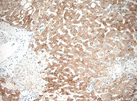 HSD17B13 Antibody in Immunohistochemistry (Paraffin) (IHC (P))