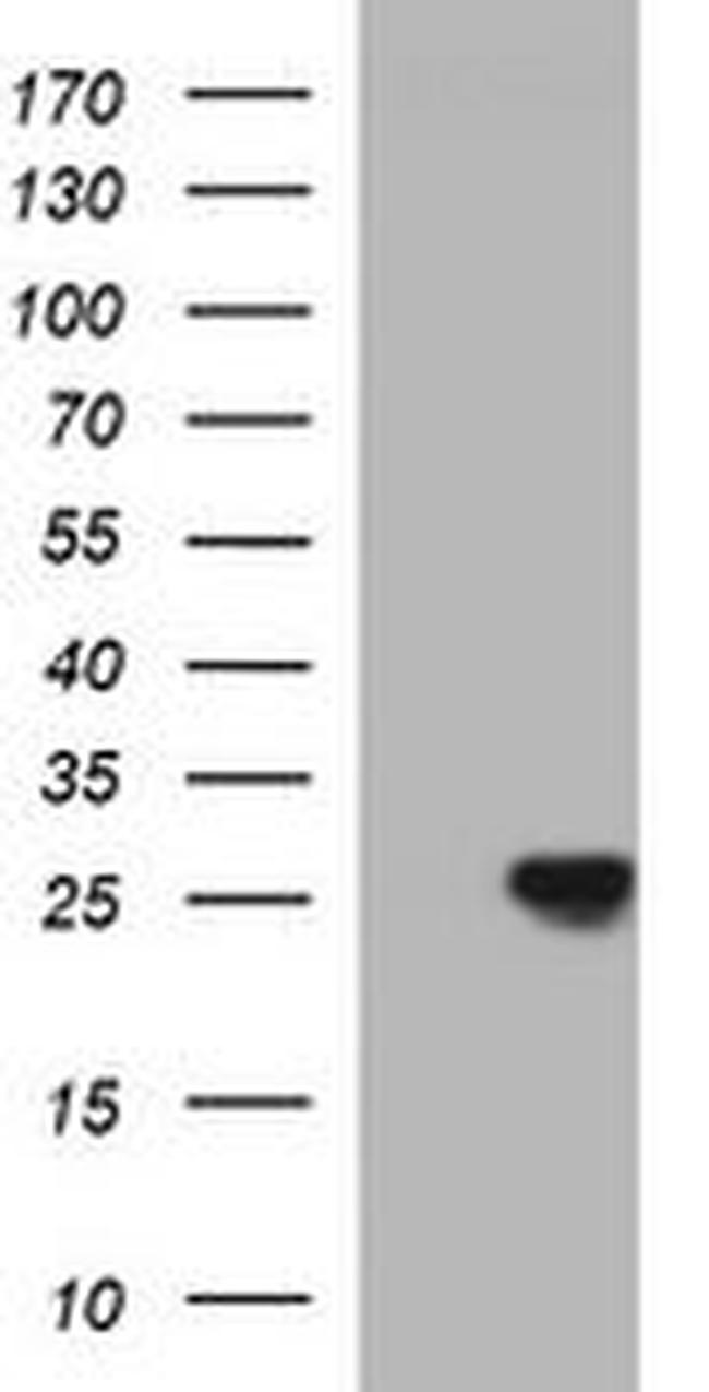 CHAC1 Antibody in Western Blot (WB)