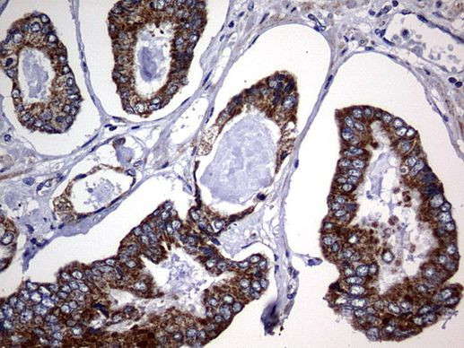 CHCHD3 Antibody in Immunohistochemistry (Paraffin) (IHC (P))