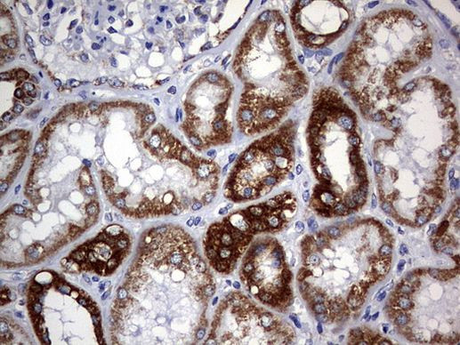 CHCHD3 Antibody in Immunohistochemistry (Paraffin) (IHC (P))