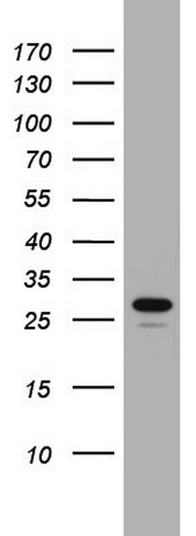 CHCHD3 Antibody in Western Blot (WB)