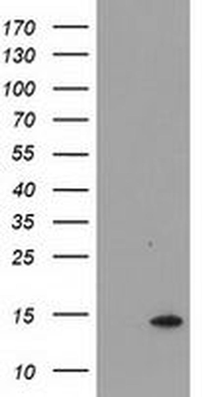 CHCHD5 Antibody in Western Blot (WB)