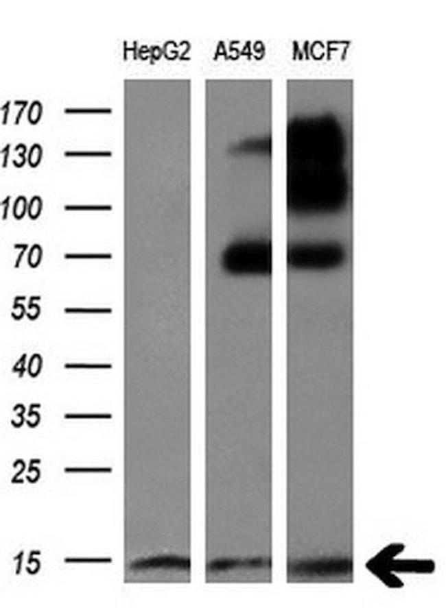 CHCHD5 Antibody in Western Blot (WB)