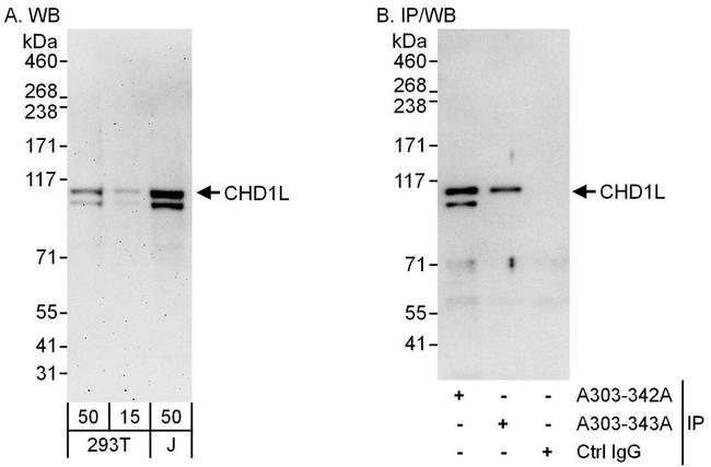 CHD1L Antibody in Western Blot (WB)