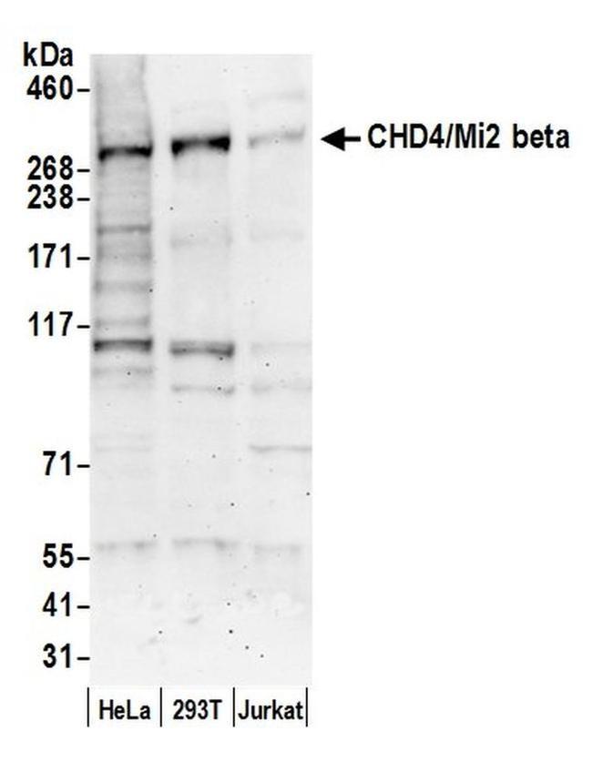 CHD4/Mi2 beta Antibody in Western Blot (WB)