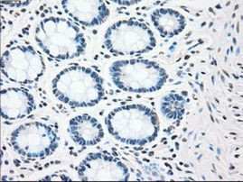 CHEK2 Antibody in Immunohistochemistry (Paraffin) (IHC (P))