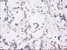 CHEK2 Antibody in Immunohistochemistry (Paraffin) (IHC (P))