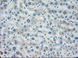 CHEK2 Antibody in Immunohistochemistry (Paraffin) (IHC (P))