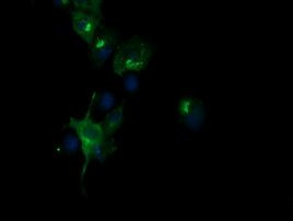 CHGA Antibody in Immunocytochemistry (ICC/IF)