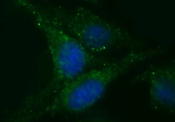 CHGA Antibody in Immunocytochemistry (ICC/IF)