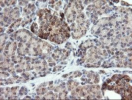 CHGA Antibody in Immunohistochemistry (Paraffin) (IHC (P))