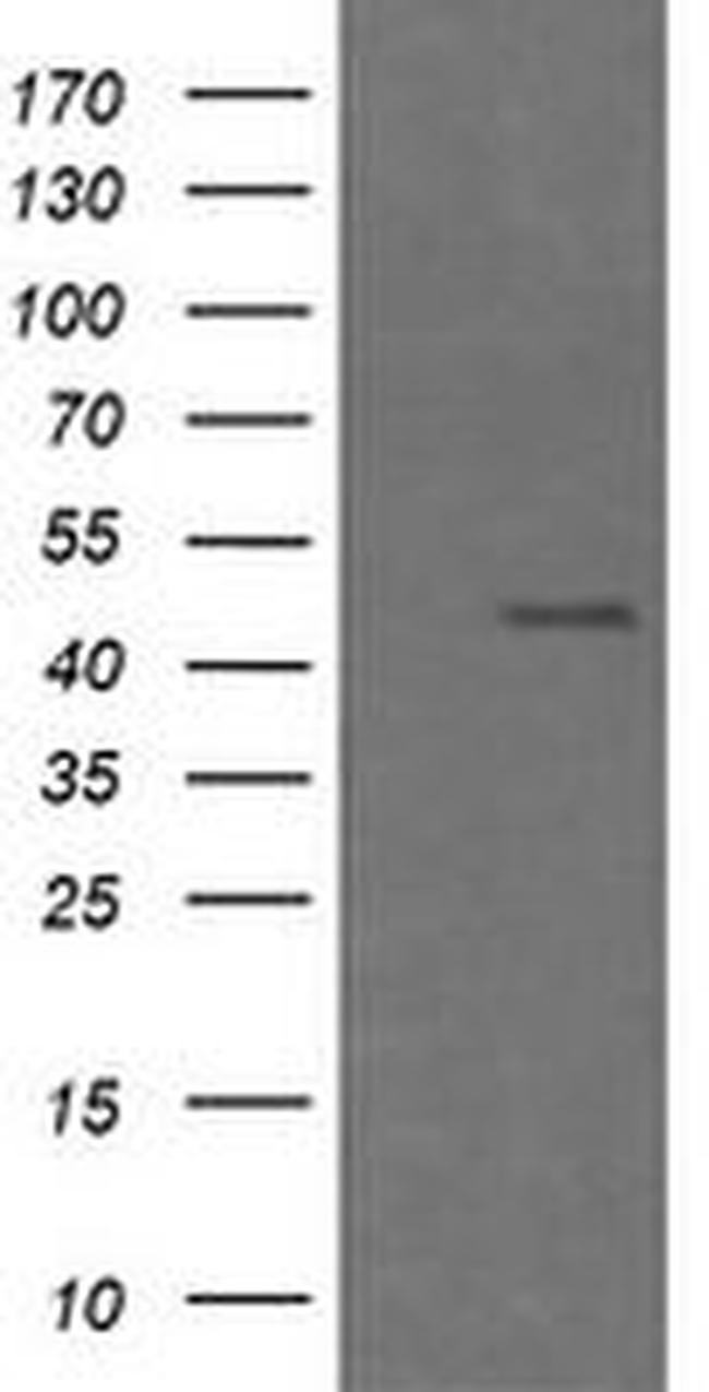 CHGA Antibody in Western Blot (WB)