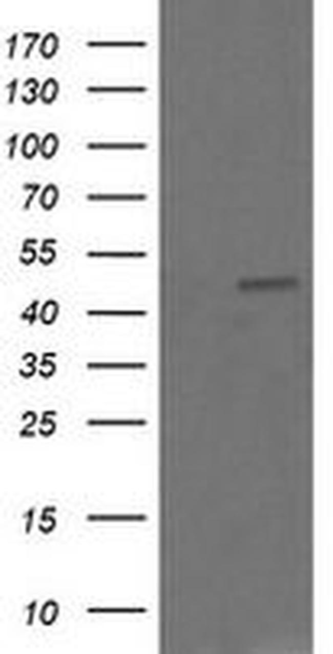 CHGA Antibody in Western Blot (WB)